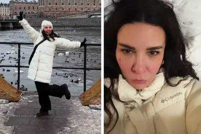 Ünlü şarkıcı Fatma Turgut'un yüzü soğuktan bu hale geldi