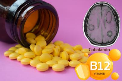 B12 vitamini herkes için gerekli mi? Bilinçsiz kullanımın perde arkası